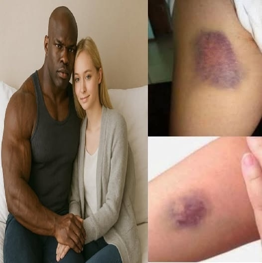 Young woman was hospitalized after being penetratedâ€¦See more (8lw)